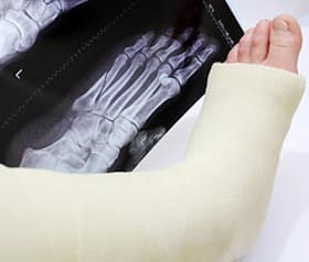 Workers Compensation & Personal Injury Attorney in St. Louis